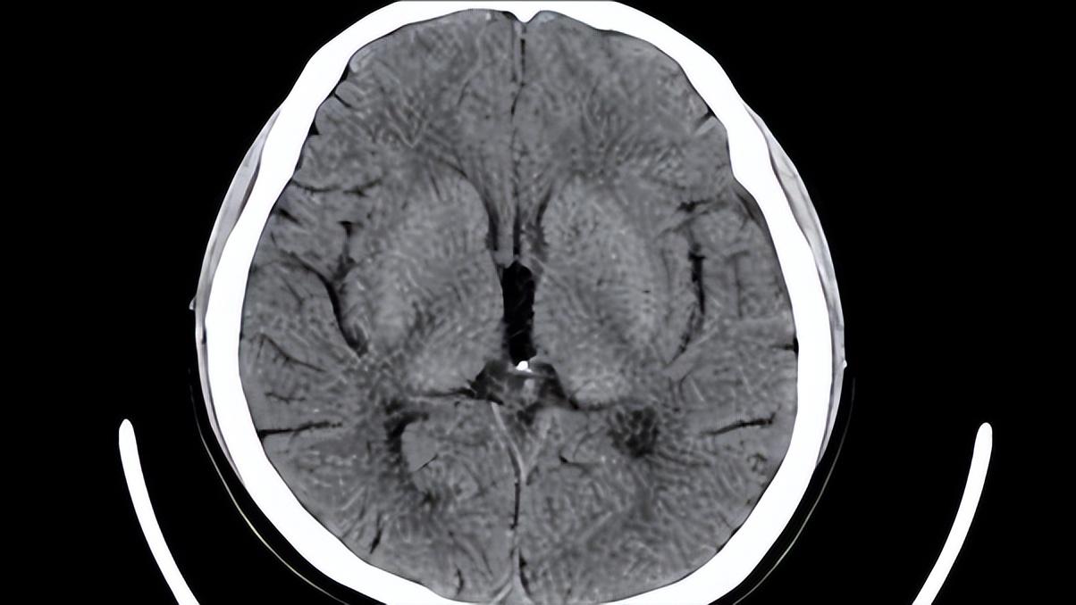 小孩检查脑ct有危害吗,年龄大了查血查什么好