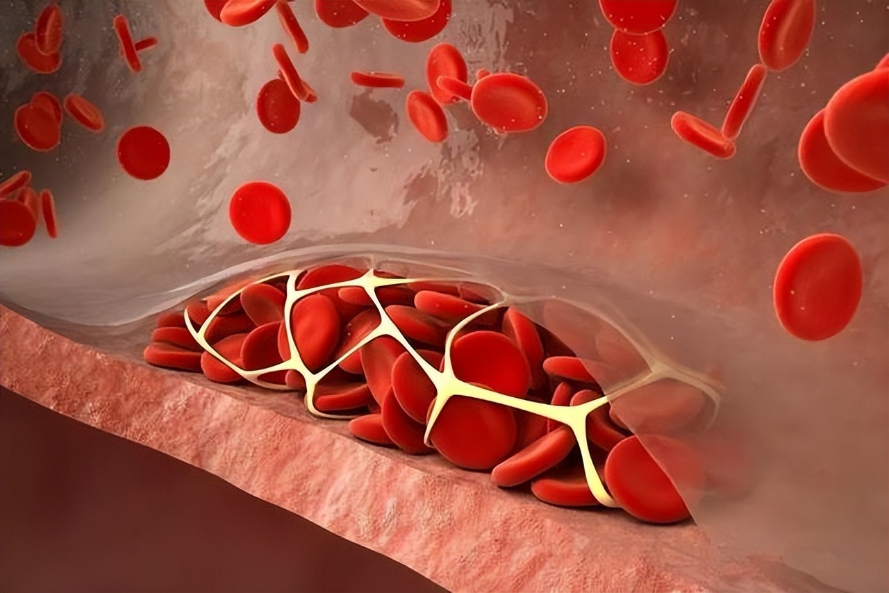 45岁女性吃叶酸有什么好,40岁后每天一片叶酸有副作用吗