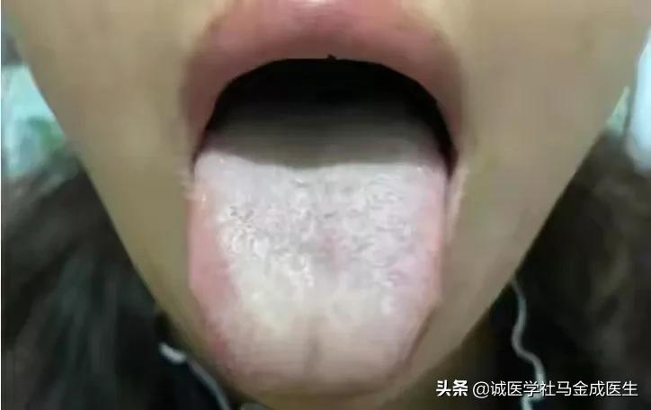 吃六味地黄丸上火？什么人不适合吃六味地黄丸？怎么吃不上火呢？