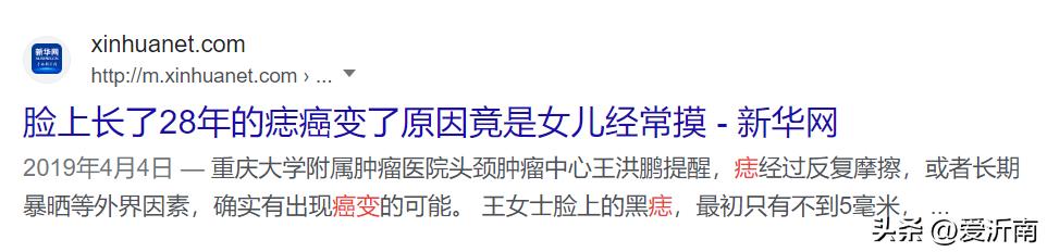 背上长了个肉痣是癌的象征吗,痣越多越容易得癌症
