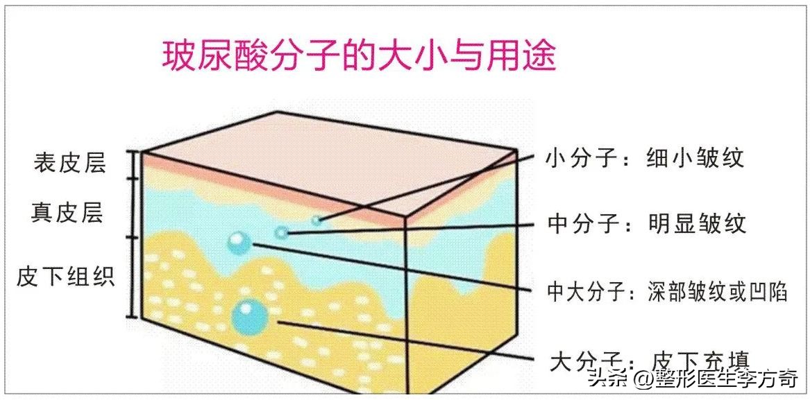 女明星爱美丽化妆品怎么样,玻尿酸功效与作用护肤
