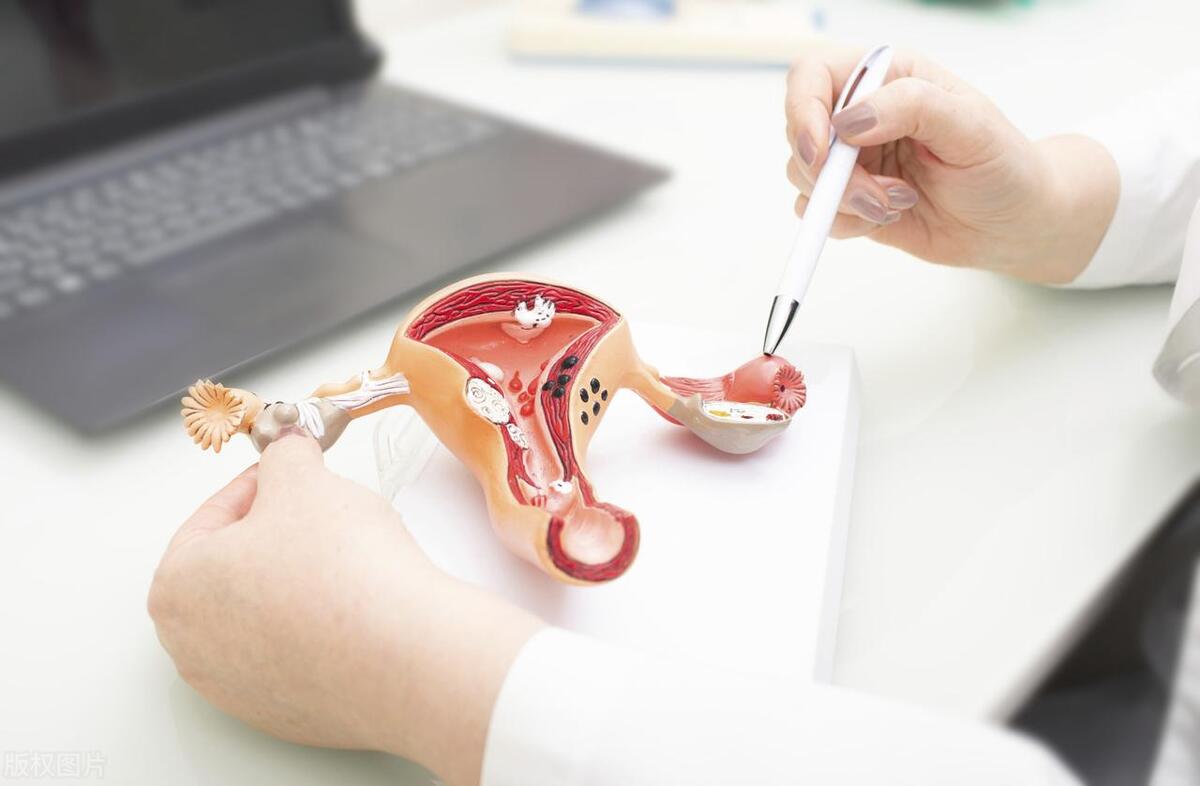 宫腹腔镜治疗输卵管成功率,宫腹腔镜输卵管疏通手术的全过程