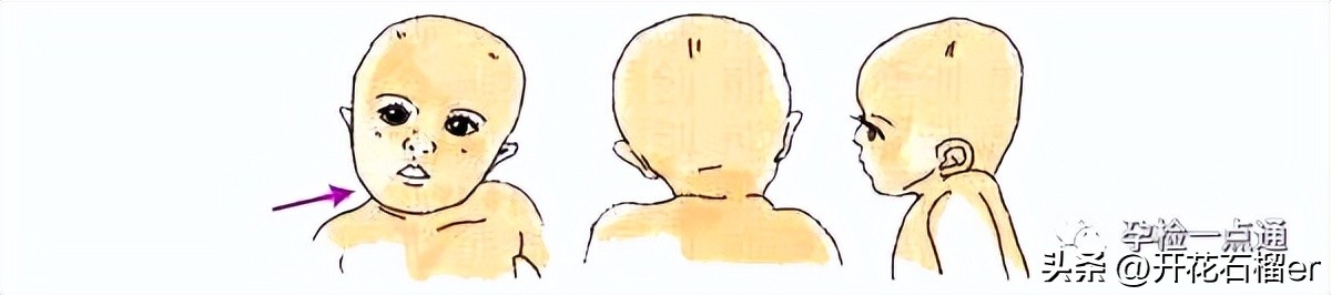 小月龄宝宝习惯把屎把尿如何纠正,8个月宝宝把屎把尿到底好不好