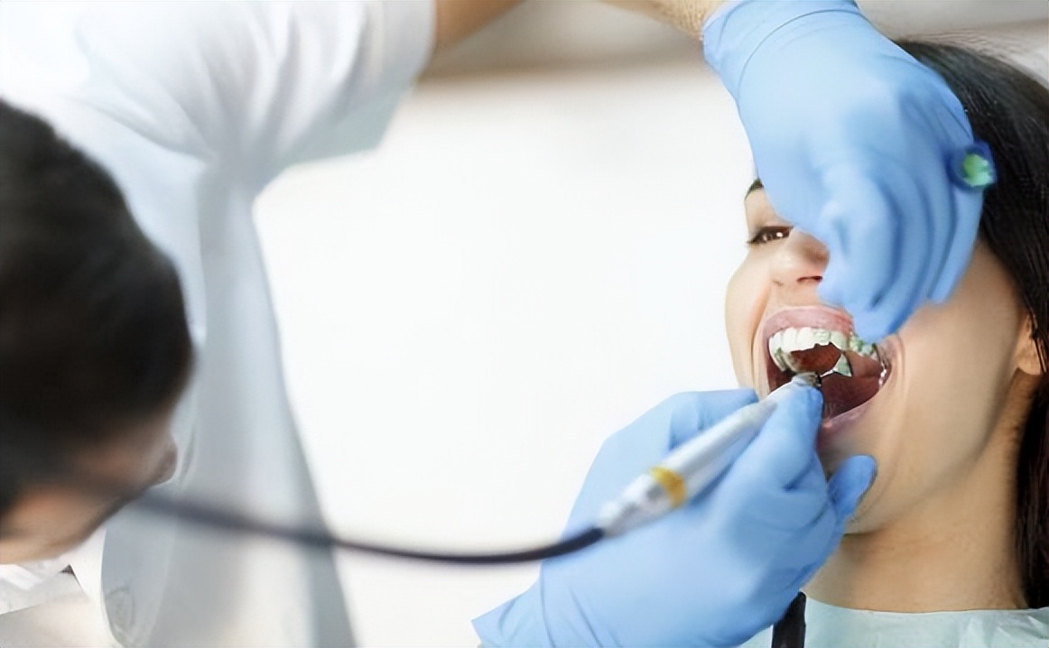 洗牙会伤害牙齿吗该不该洗牙,深度洗牙对牙齿有伤害吗