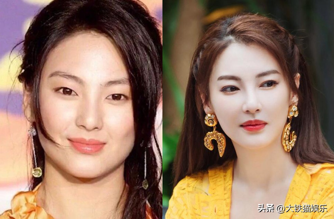 割过双眼皮的女明星对比,割双眼皮失败的明星谁最惨