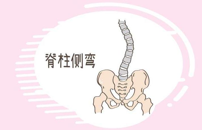 脊柱侧弯保守治疗可以报销吗,脊柱侧弯手术15万能报销多少