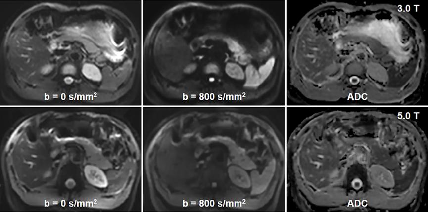 联影上市视频,联影上市晚会