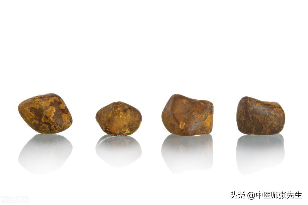 中医说结石是什么原因造成的,中医认为结石是什么原因引起的