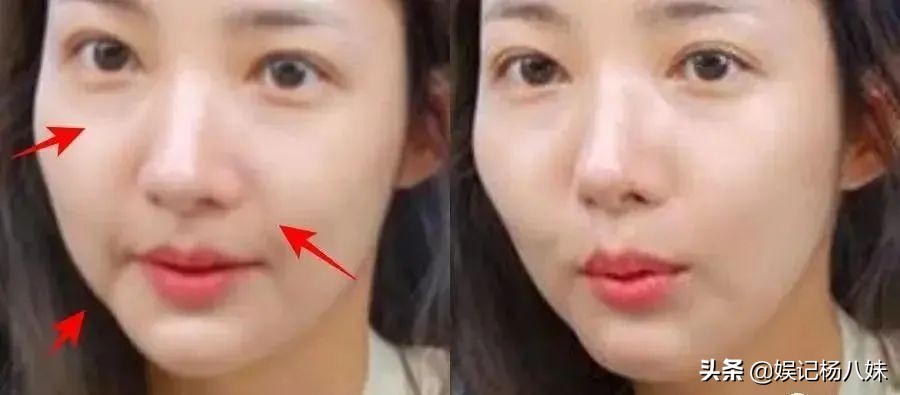 8位中韩女神的“颜值克星”！法令纹在脸上“修渠”，个个显老
