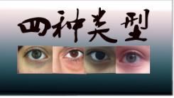 各种黑眼圈最全解决方案赶紧收藏,这才是黑眼圈的最佳解决方法