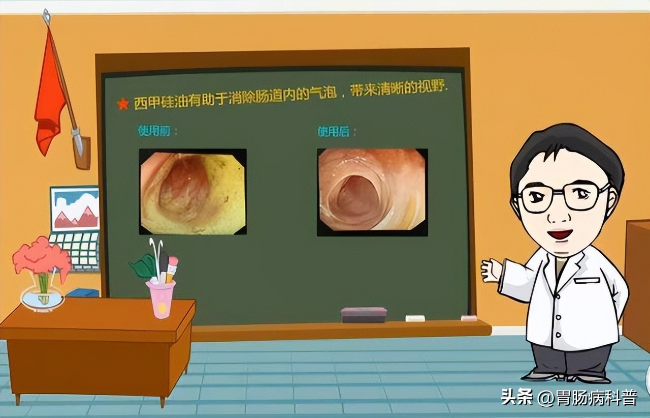 做肠镜检查前怎样清肠最彻底,肠镜检查前清肠的药怎么喝