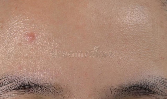 三天不洗脸，皮肤会怎么样？是越来越差，还是会越来越好