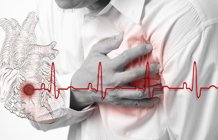 冠心病胸闷、气短、胸痛3年老中医中药2周改善