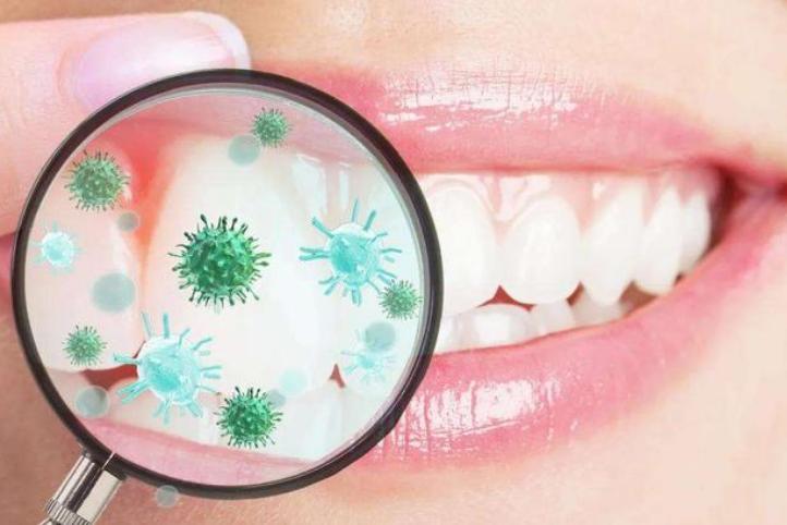 牙套清洁牙膏,戴牙套可以用牙粉吗