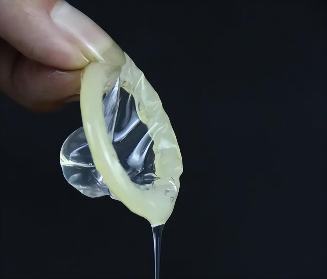 为啥安全套要导热,为什么安全套会过敏