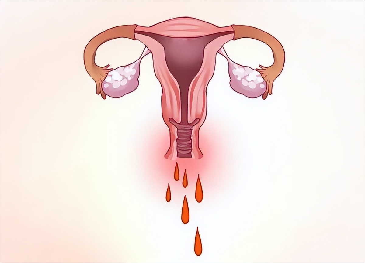 为什么女人小便后,要用纸擦一下呢?医生:很有必要