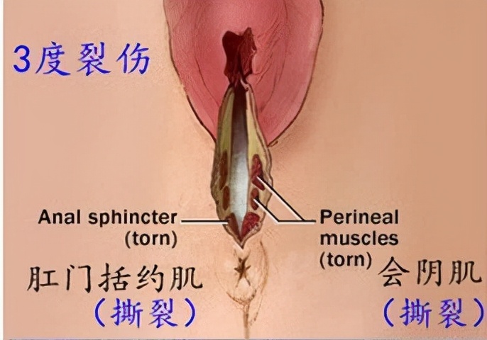 俏管家家政孕期腰酸背痛？这些缓解方法一天一种，亲测超级管用