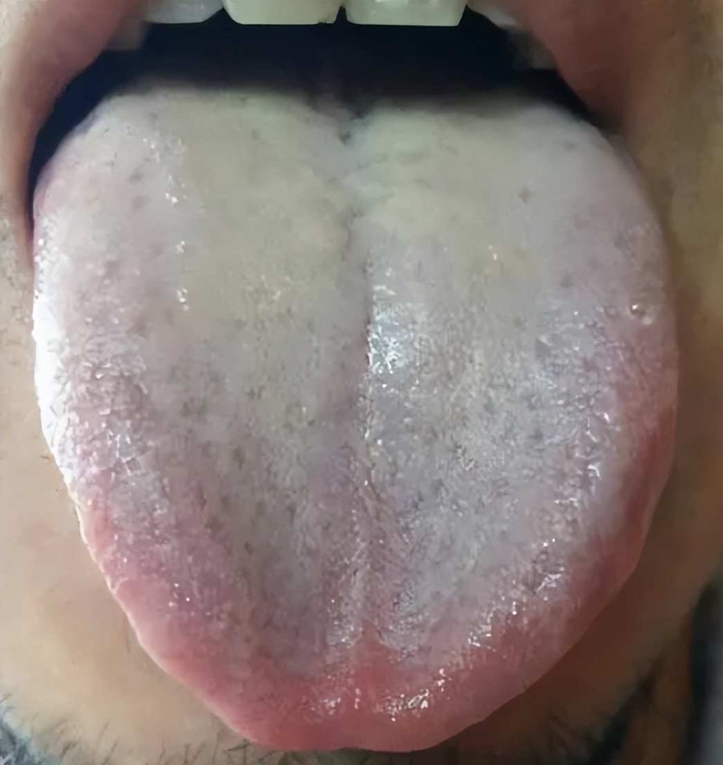 人体脾虚怎么调养,脾胃湿热和脾虚吃什么中成药