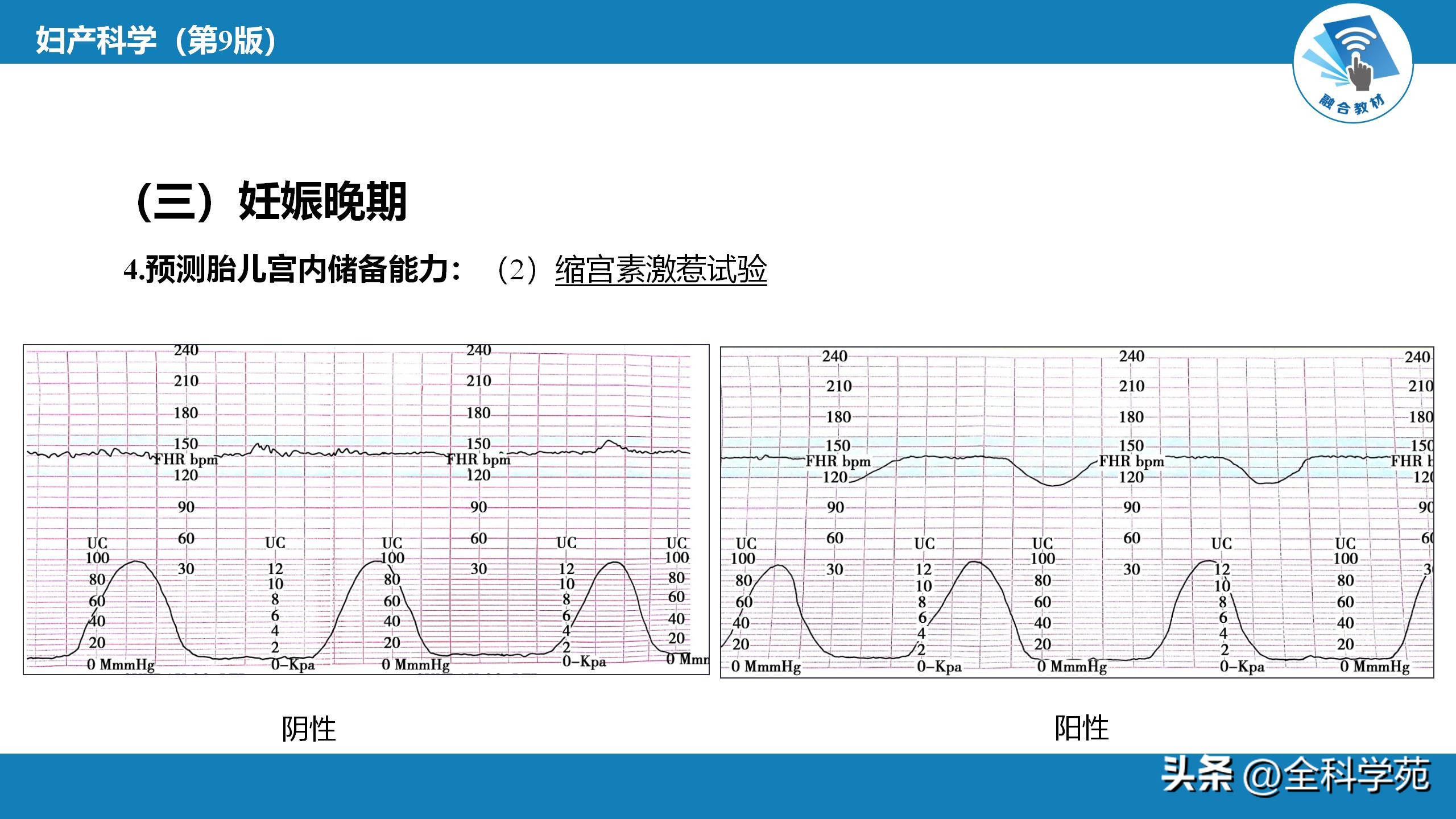 第六章—产前检查与孕期保健