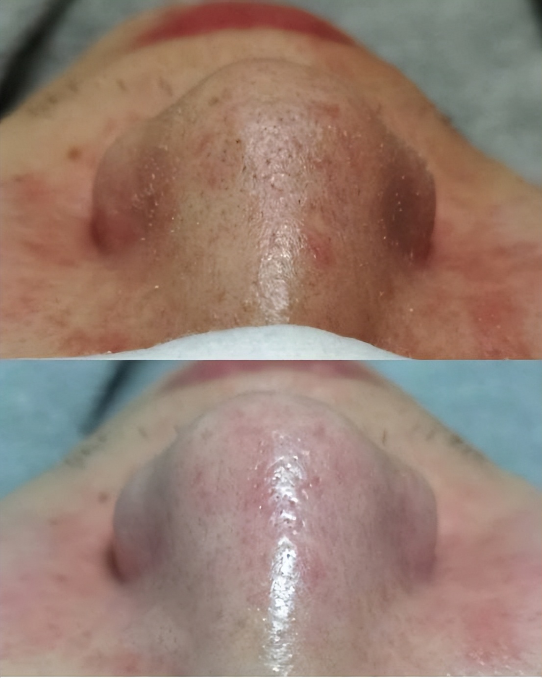 卸粉底后感觉鼻子上的毛孔有白点,为什么上完粉底液鼻子上有黑点