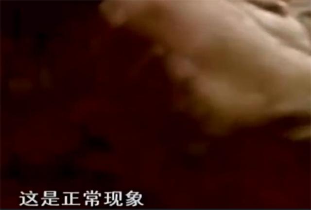 孩子药浴洗出绝症母亲肠子悔青,给孩子洗药浴洗出绝症