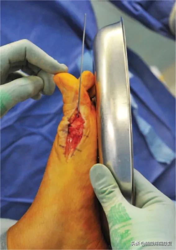 让脚变瘦的动作方法,有助于身体健康的动作