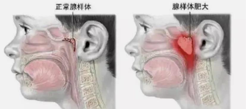在*裤内**里加燕窝和胶原这种鬼话都说得出来？