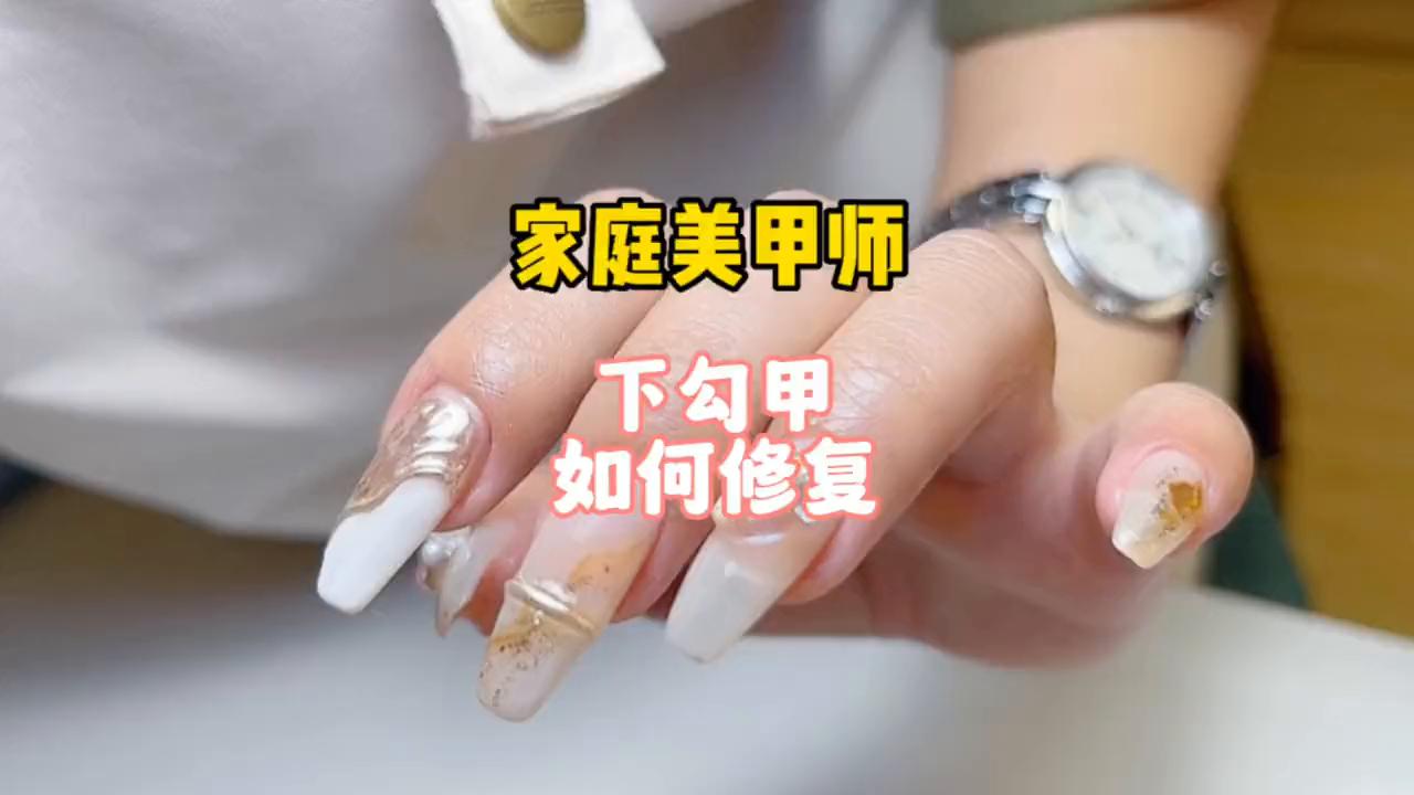 下勾甲怎么改善,被人勾肩搭背如何化解