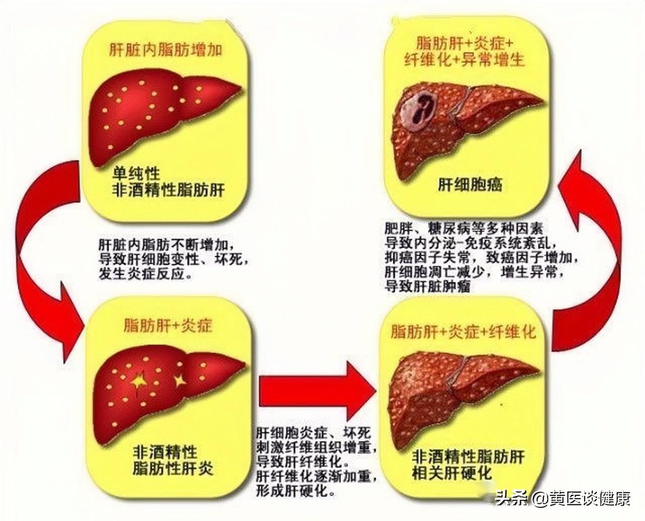 乙肝表面抗原定性高,乙肝病毒dna转阴表面抗原偏高