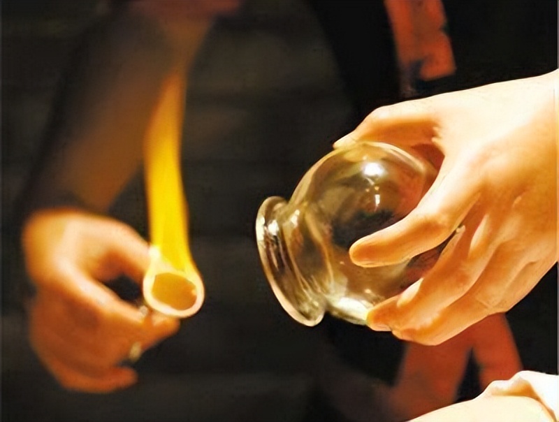 拔罐罐法,拔罐技术与方法