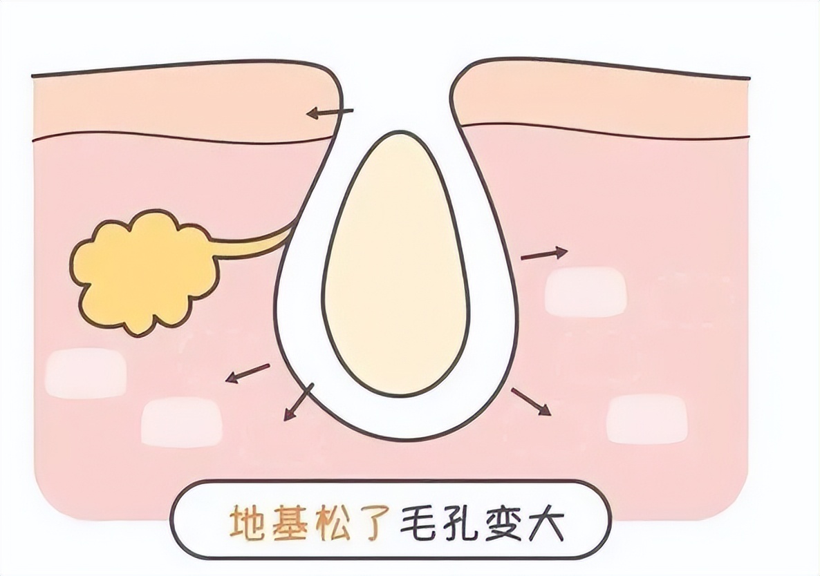 看不爽的黑头要这样对付它(二)方法篇