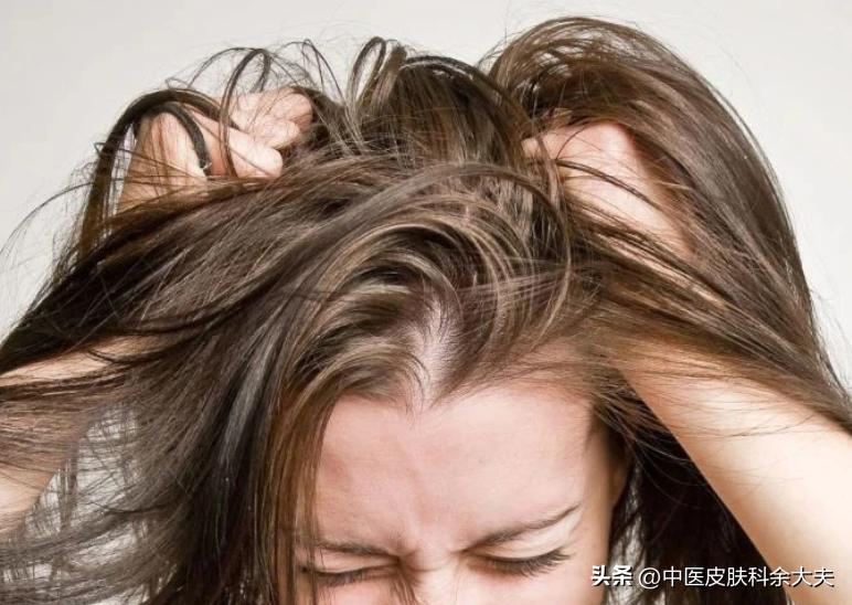 脱发是气血不好的表现吗,脱发说是内分泌失调什么意思