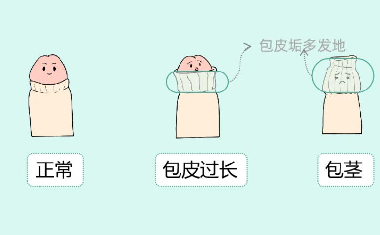 你知道：男性丁丁的发育变化是怎样的吗？如有3大异常及时就医