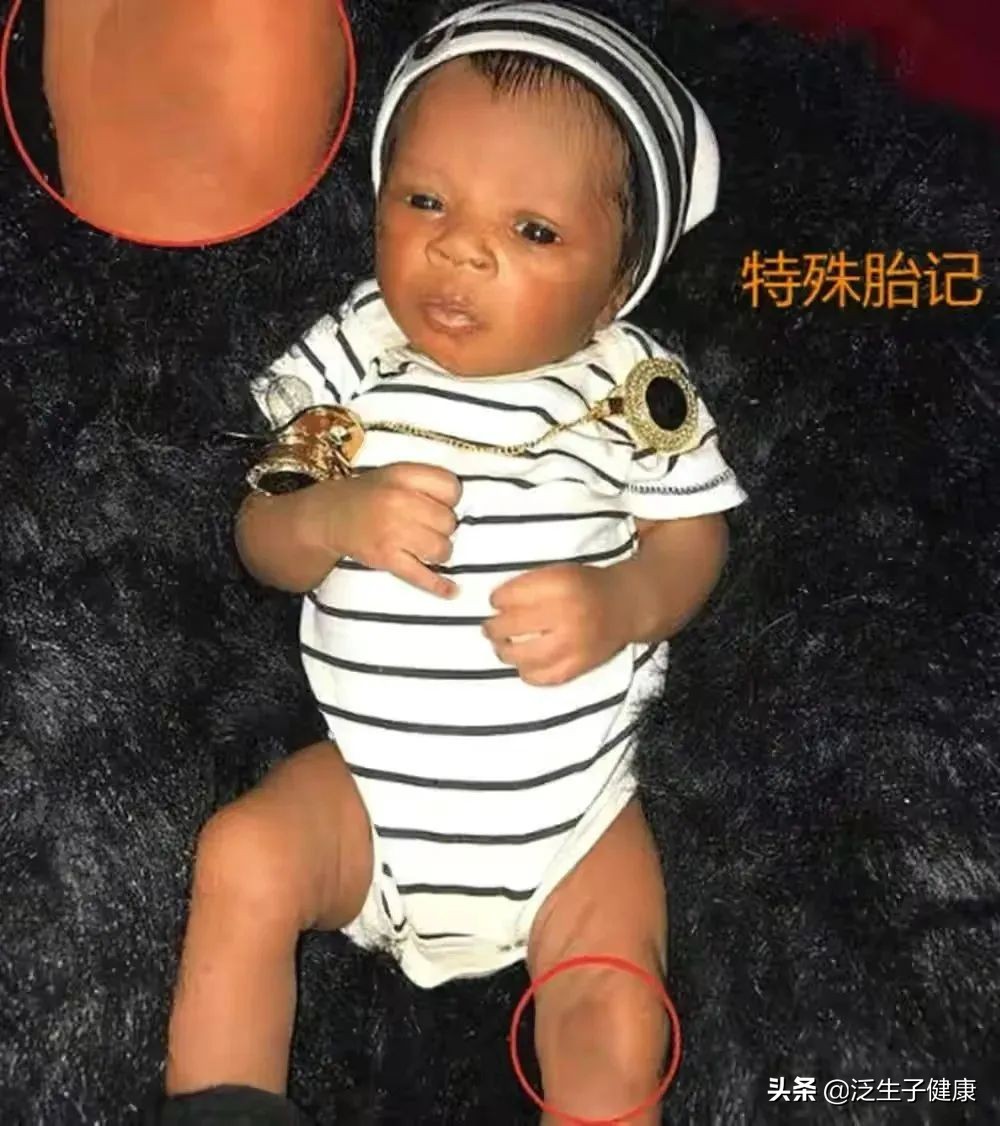 怀了双胞胎，最后却只有一个孩子？原来是一个“吃”掉了另一个