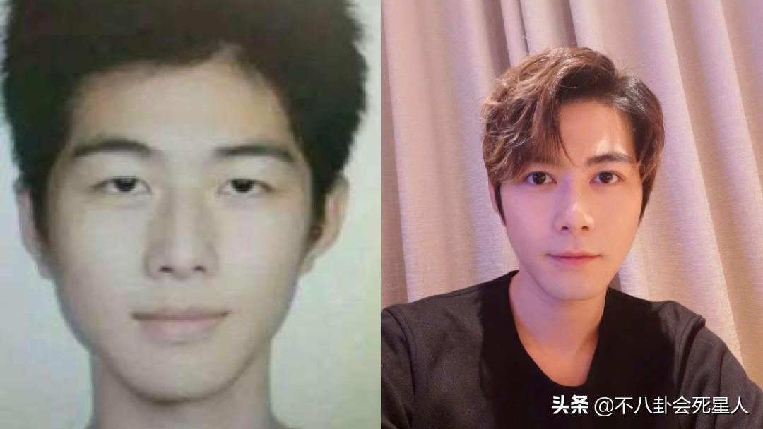 景甜悲伤蛙双眼皮照片,明星割双眼皮前后对比图