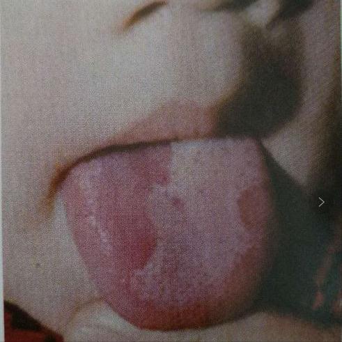 舌诊辨证和精准用药,中医诊病无需诊脉和观舌象靠谱不