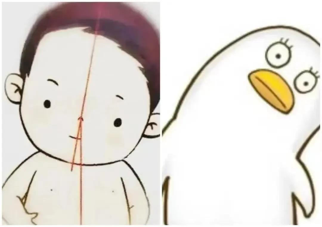 宝宝歪颈和斜颈的症状,婴儿斜颈左侧歪头怎么纠正