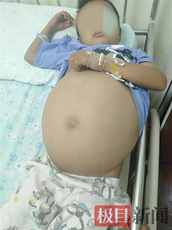 小男孩割肝救母,广西小孩割肝救子