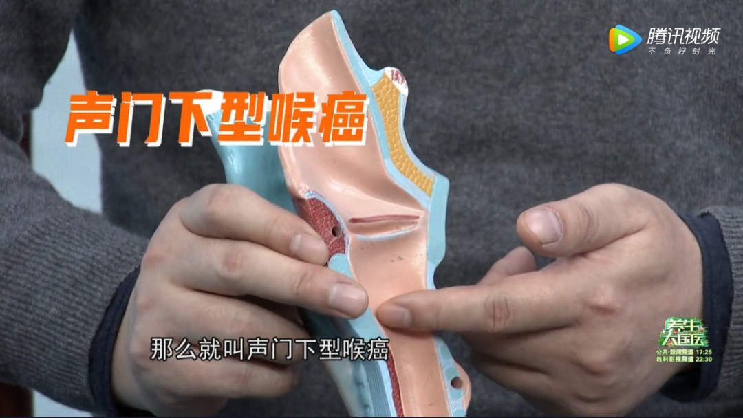 喉咙干痒、咳嗽你以为是咽喉炎？很可能是喉癌！40岁以上的男性注意了，你们是高发人群