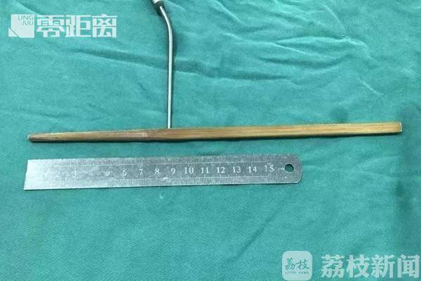 孩子被铅笔扎了眼睛,孩子在校被铅笔刺伤眼球