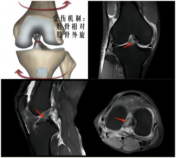 健康小知识运动损伤的常见症状,运动损伤知识科普宣传内容