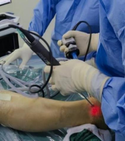 扭伤脚踝五十多天了走路就肿,踝关节扭伤半年后突然疼痛