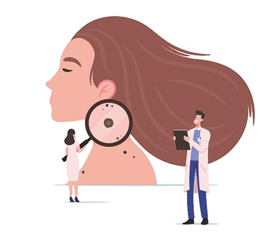 肉痣变大开花是怎么回事,歪草