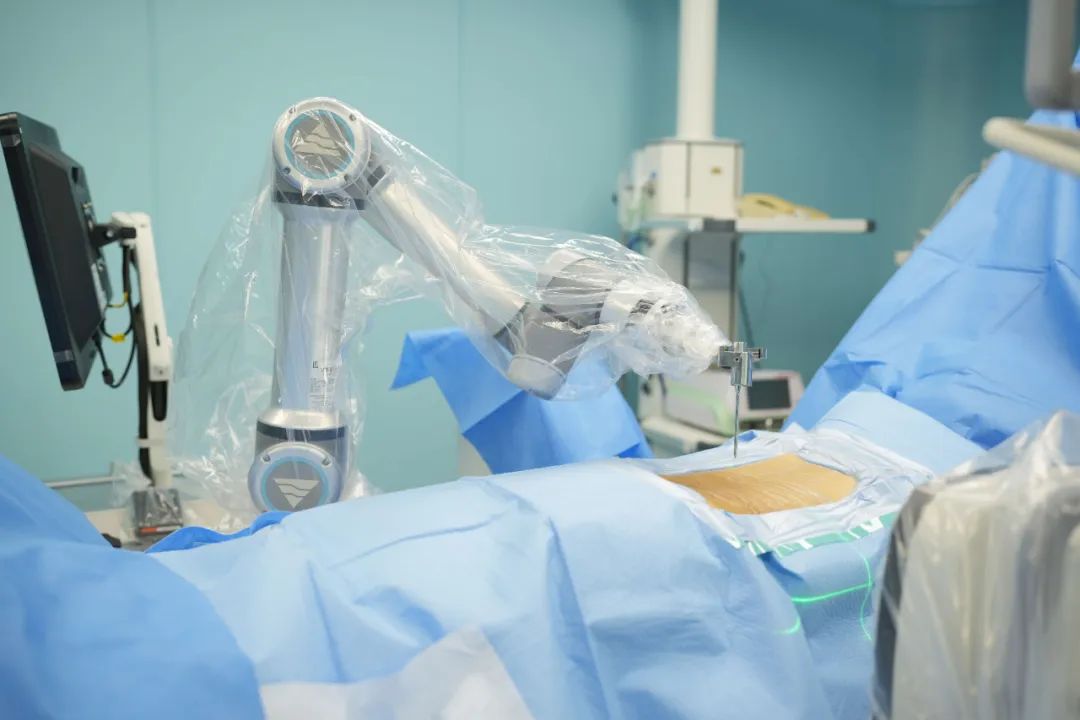 智能多功能骨科手术机器人,智慧微创骨科